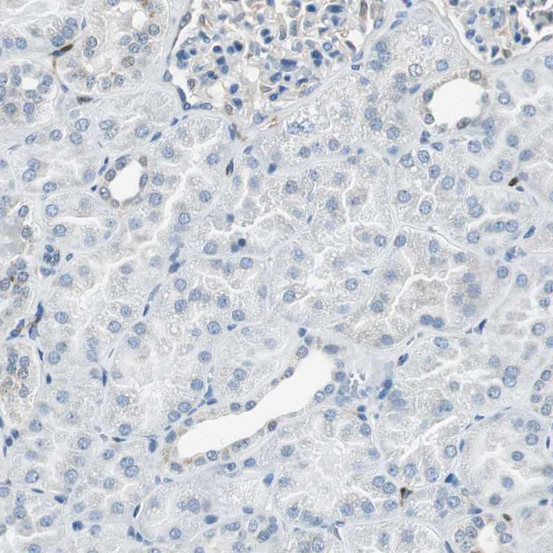 Staining of human kidney shows no positivity in cells in tubules as expected.