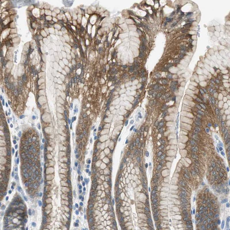 Staining of human stomach shows moderate cytoplasmic positivity in glandular cells.