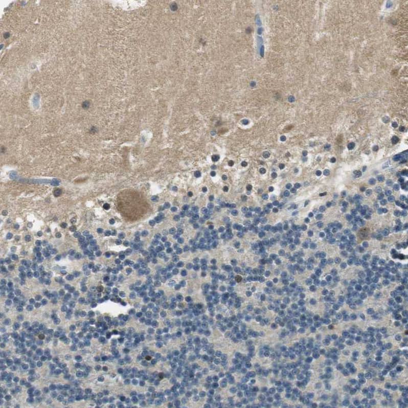 Staining of human cerebellum shows weak cytoplasmic positivity in Purkinje cells.