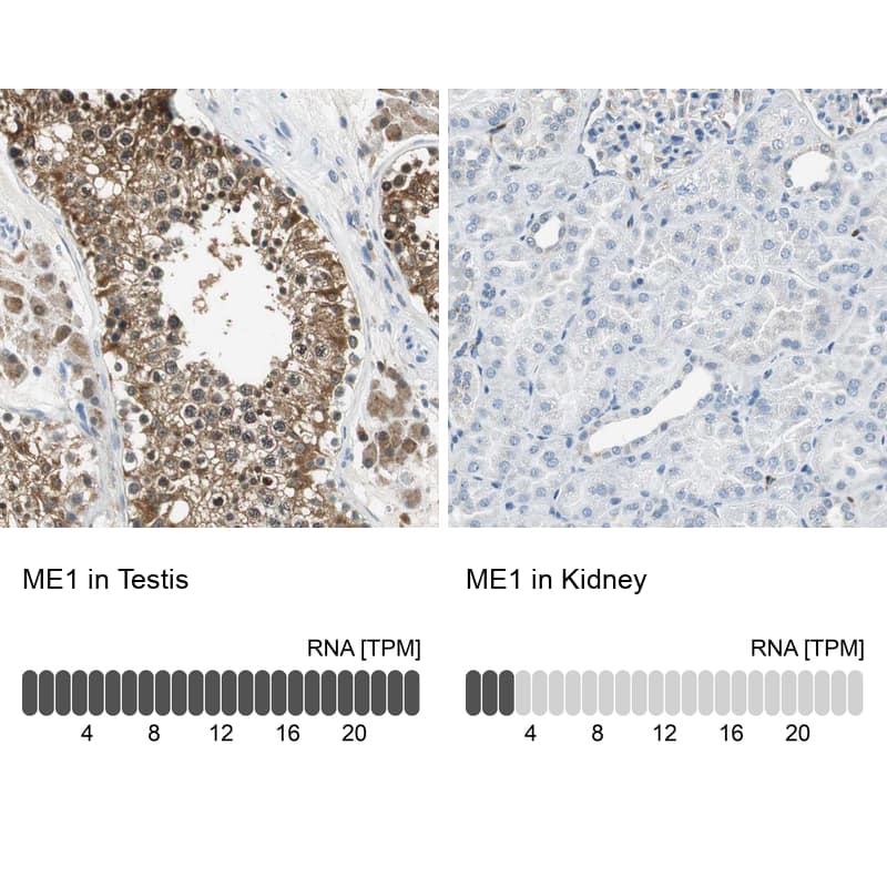 Immunohistochemistry analysis in human testis and kidney tissues using HPA006493 antibody. Corresponding ME1 RNA-seq data are presented for the same tissues.