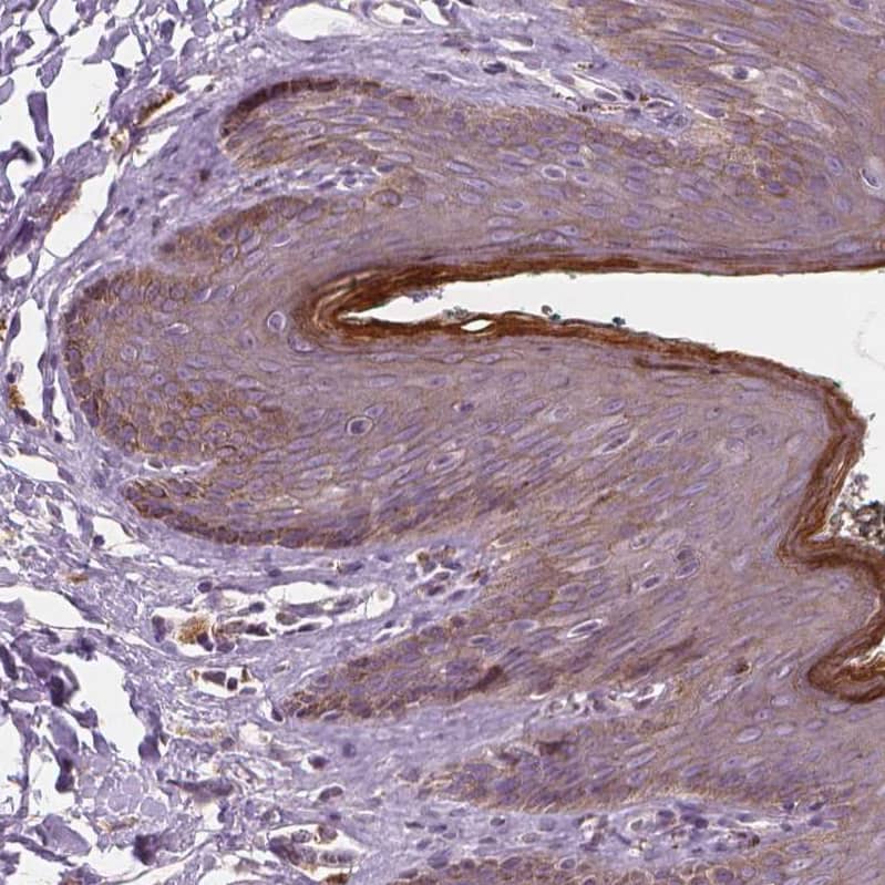 Staining of human skin shows weak cytoplasmic positivity in squamous epithelial cells.
