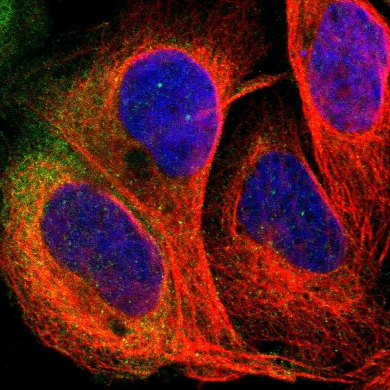 Staining of human cell line U-2 OS shows localization to cytosol.