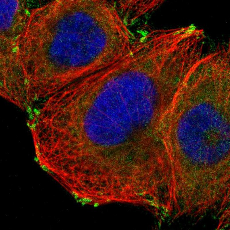 Staining of human cell line A-431 shows localization to cytosol & focal adhesion sites.