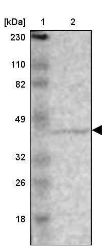 Lane 1: Marker [kDa] 230, 110, 82, 49, 32, 26, 18Lane 2: Human cell line RT-4