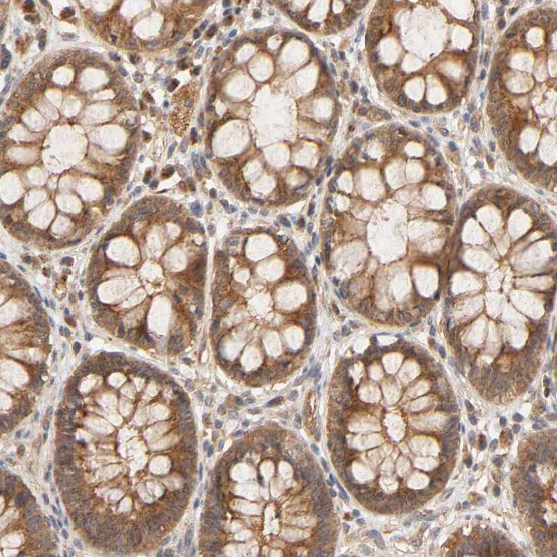 Staining of human rectum shows moderate cytoplasmic positivity in glandular cells.