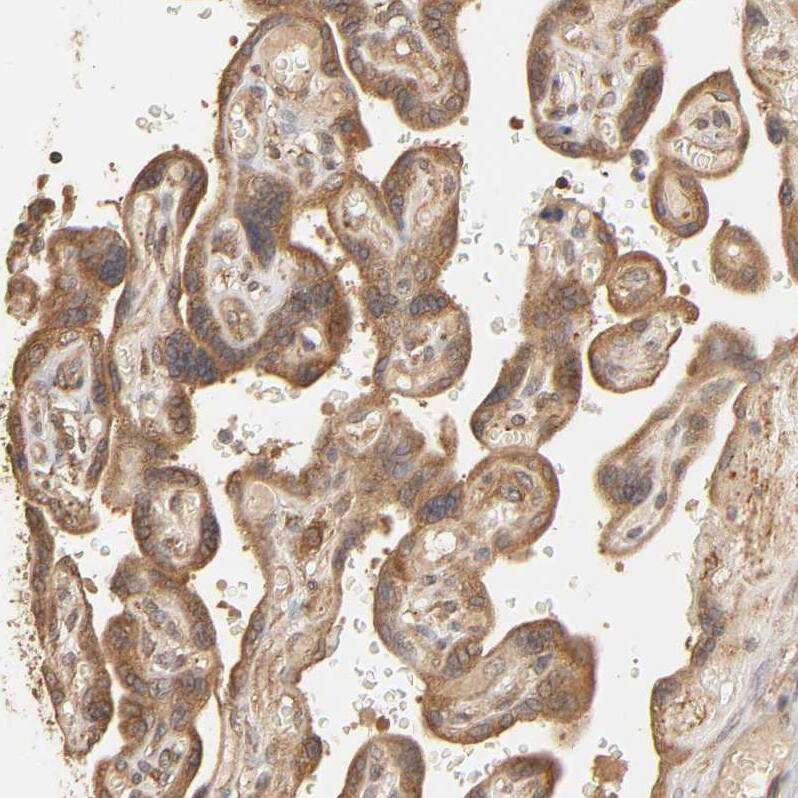 Staining of human placenta shows moderate cytoplasmic positivity in trophoblastic cells.