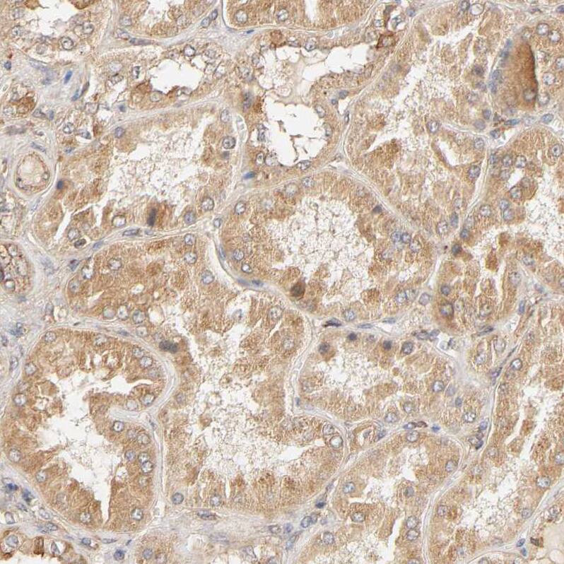 Staining of human kidney shows moderate cytoplasmic positivity in cells in tubules.