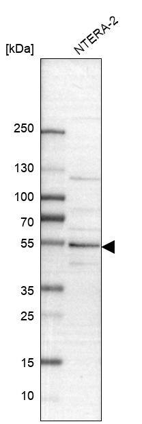 Analysis in human cell line NTERA-2.