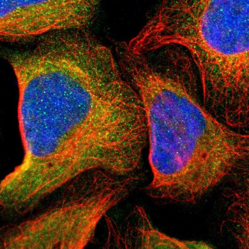 Staining of human cell line U-2 OS shows localization to cytosol.