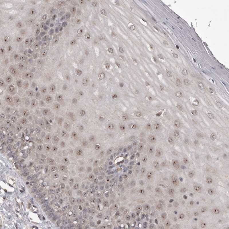 Staining of human cervix, uterine shows distinct nucleolar positivity in squamous epithelial cells.