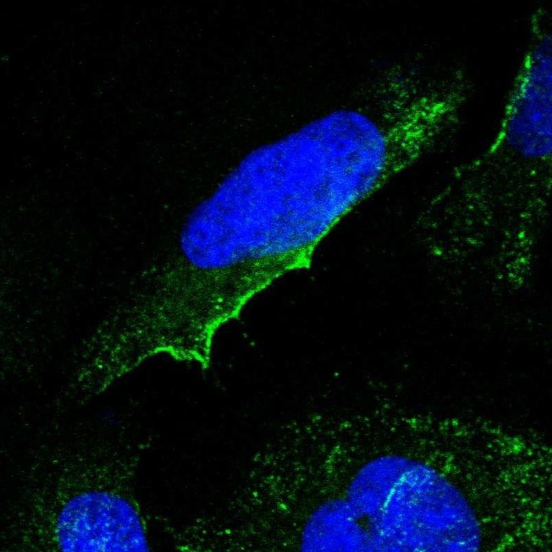 Staining of human cell line U-2 OS shows localization to plasma membrane & vesicles.