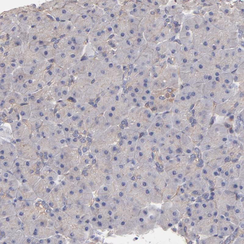 Staining of human pancreas shows low expression as expected.