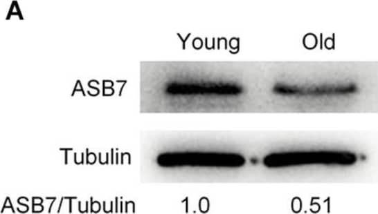 ASB7 overexpression alleviates maternal age-induced oocyte meiotic defects. (A) Representative Western blot showing the ASB7 expression in oocytes from young and old mice (100 oocytes per lane). (B) Schematic illustration of the experimental procedure for overexpression. (C) Representative Western blot result shows the efficiently overexpressed exogenous ASB7 protein. (D) Young, old, old + PBS, and old + ASB7 oocytes were stained with  alpha -tubulin antibody to visualize spindle (green) and counterstained with PI to visualize chromosome (red). Yellow arrowheads direct to the disorganized spindles and white arrows indicate the misaligned chromosomes. Scale bar: 30 μm. (E) Quantification of young (n = 103), old (n = 112), old + PBS (n = 115), and old + ASB7 (n = 104) oocytes with spindle/chromosome defects. (F) Chromosome spread of young, old, old + PBS, and old + ASB7 MII oocytes. Chromosomes were stained with Hoechst 33342 (blue), and kinetochores were labeled with CREST (purple). Scale bar: 10 μm. (G) Quantification of aneuploidy in young (n = 35), old (n = 38), old + PBS (n = 34), and old + ASB7 (n = 32) oocytes. Data are expressed as mean percentage +/- SEM of three independent experiments. *p < 0.05 vs controls. Image collected and cropped by CiteAb from the following open publication (//pubmed.ncbi.nlm.nih.gov/33251222), licensed under a CC-BY license. Not internally tested by Novus Biologicals.