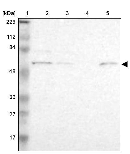 Lane 1: Marker [kDa] 229, 112, 84, 48, 32, 27, 17Lane 2: Human cell line RT-4Lane 3: Human cell line U-251MG spLane 4: Human plasma (IgG/HSA depleted)Lane 5: Human liver tissue