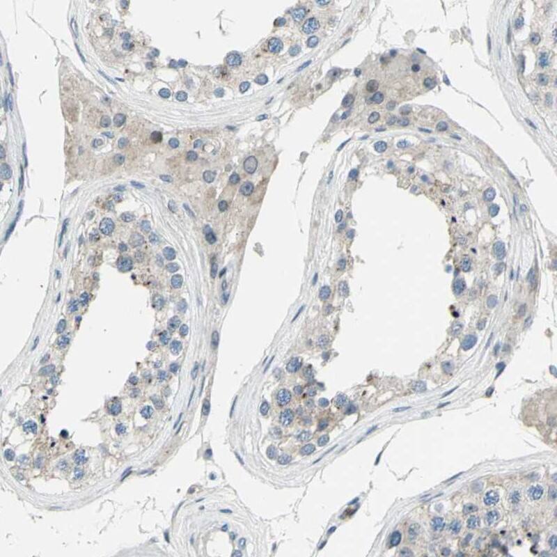 Immunohistochemistry-Paraffin ZNF184 Antibody - BSA Free