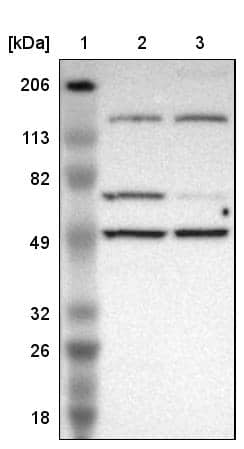 Lane 1: Marker [kDa] 206, 113, 82, 49, 32, 26, 18Lane 2: Human cell line RT-4Lane 3: Human cell line U-251MG sp