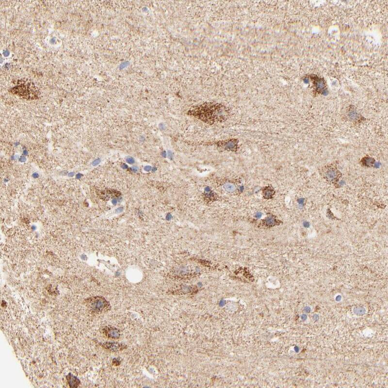 Staining of human cerebral cortex shows strong cytoplasmic positivity in granular pattern in neuronal cells.