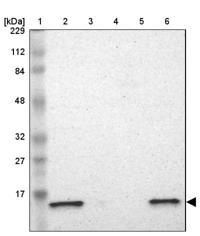 Western Blot ATP5D Antibody - BSA Free