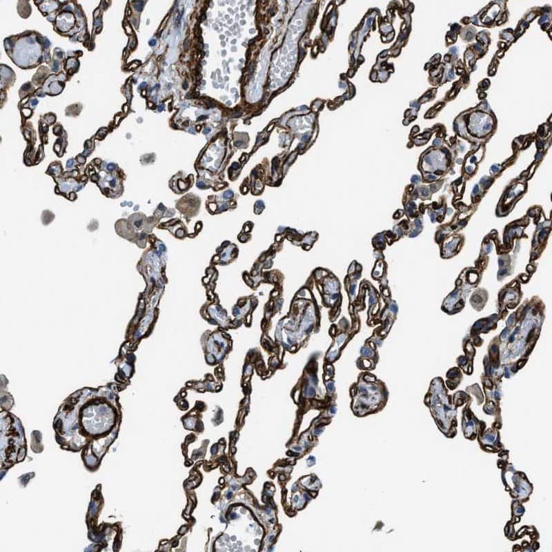 Staining of human lung shows strong membranous positivity in pneumocytes.