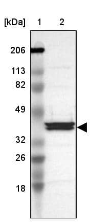 Lane 1: Marker [kDa] 206, 113, 82, 49, 32, 26, 18Lane 2: Human cell line RT-4