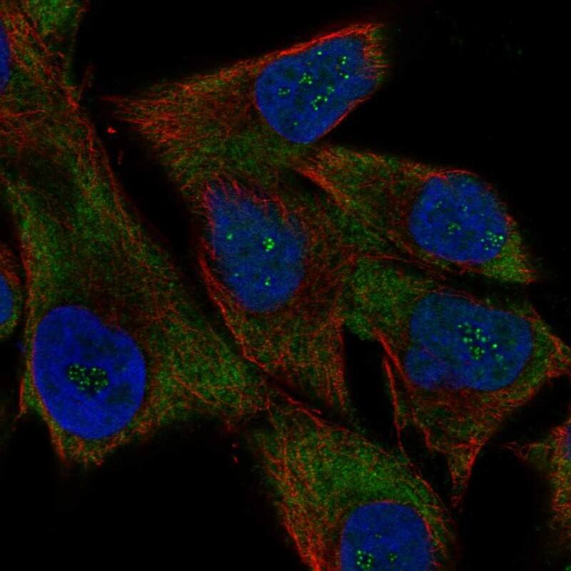 Staining of human cell line SK-MEL-30 shows localization to nucleoli fibrillar center & cytosol.