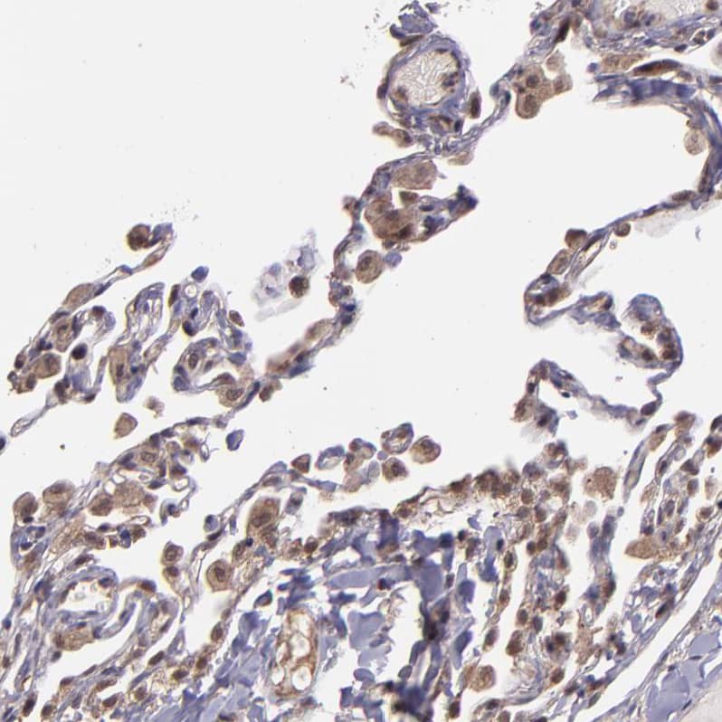 Staining of human lung shows moderate cytoplasmic and nuclear positivity in pneumocytes.