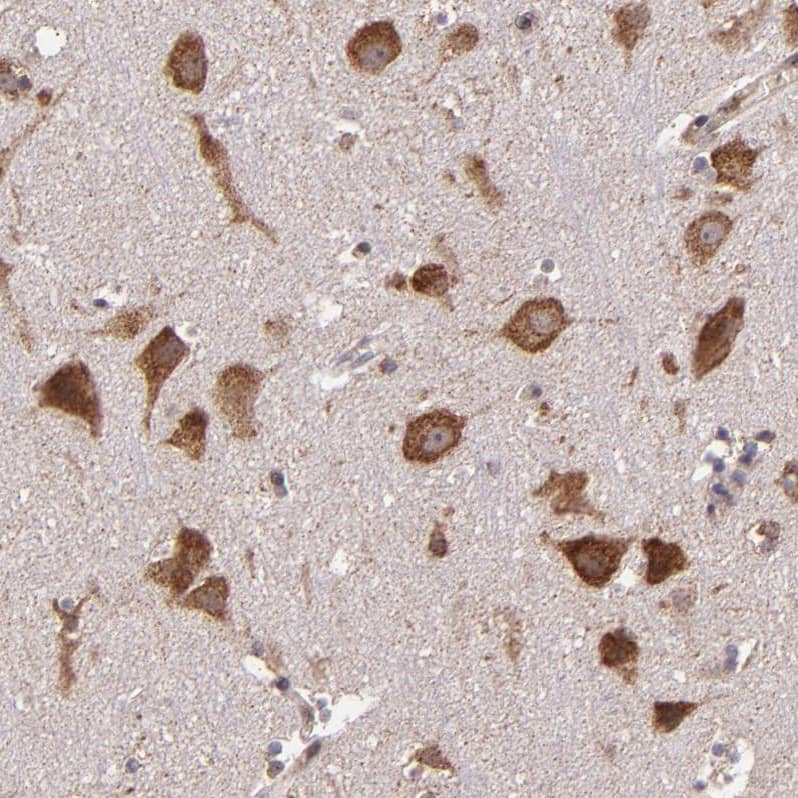 Staining of human cerebral cortex shows strong cytoplasmic positivity in neurons.