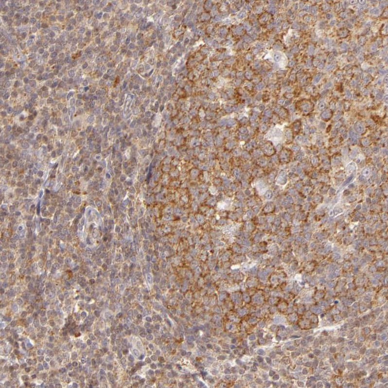 Staining of human tonsil shows strong cytoplasmic positivity in germinal center cells.