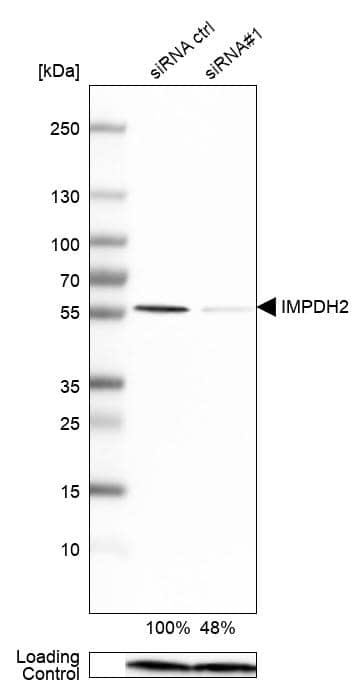 <b>Genetic Strategies Validation. </b>Analysis in U-251MG cells transfected with control siRNA, target specific siRNA probe #1, using Anti-IMPDH2 antibody. Remaining relative intensity is presented. Loading control: Anti-PPIB.