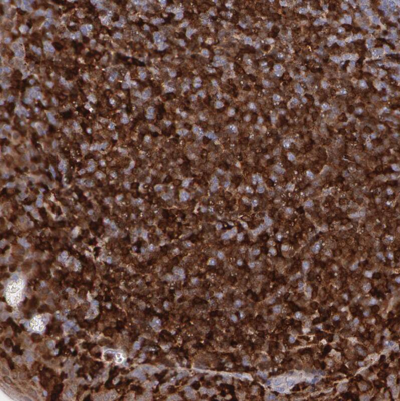 Staining of human tonsil shows strong cytoplasmic positivity in germinal center cells.