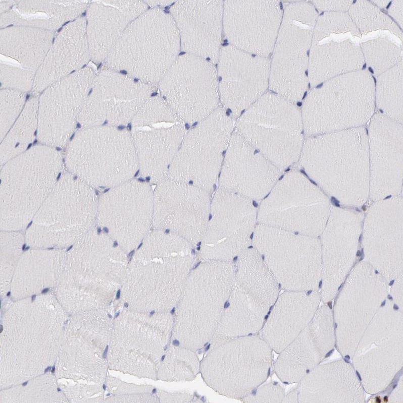 Staining of human skeletal muscle shows no cytoplasmic positivity in myocytes as expected.