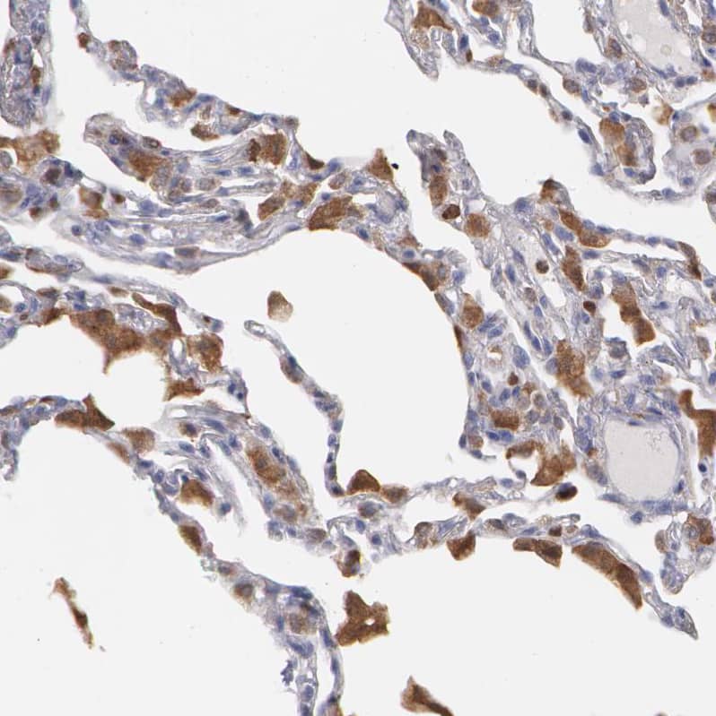 Staining of human lung shows strong cytoplasmic positivity in macrophages.