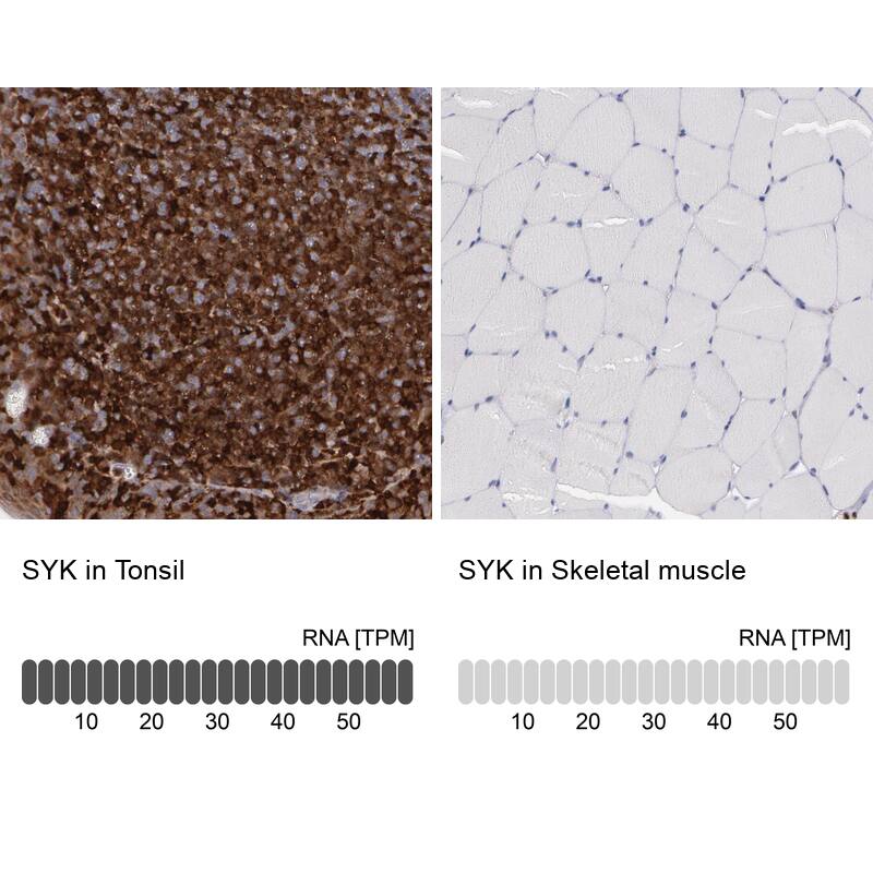 Immunohistochemistry analysis in human tonsil and skeletal muscle tissues using HPA001384 antibody. Corresponding SYK RNA-seq data are presented for the same tissues.