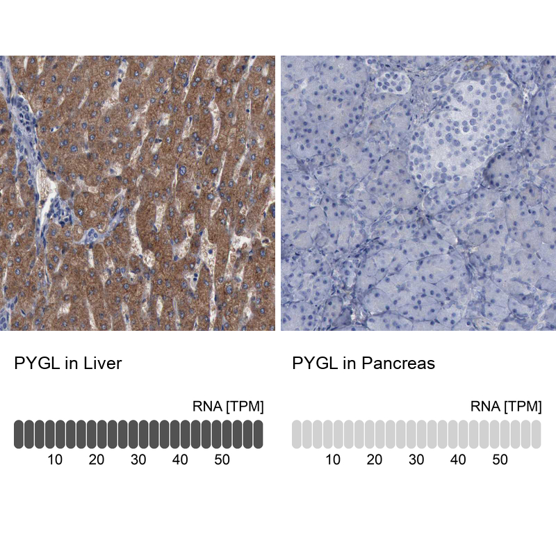 Immunohistochemistry-Paraffin PYGL Antibody - BSA Free