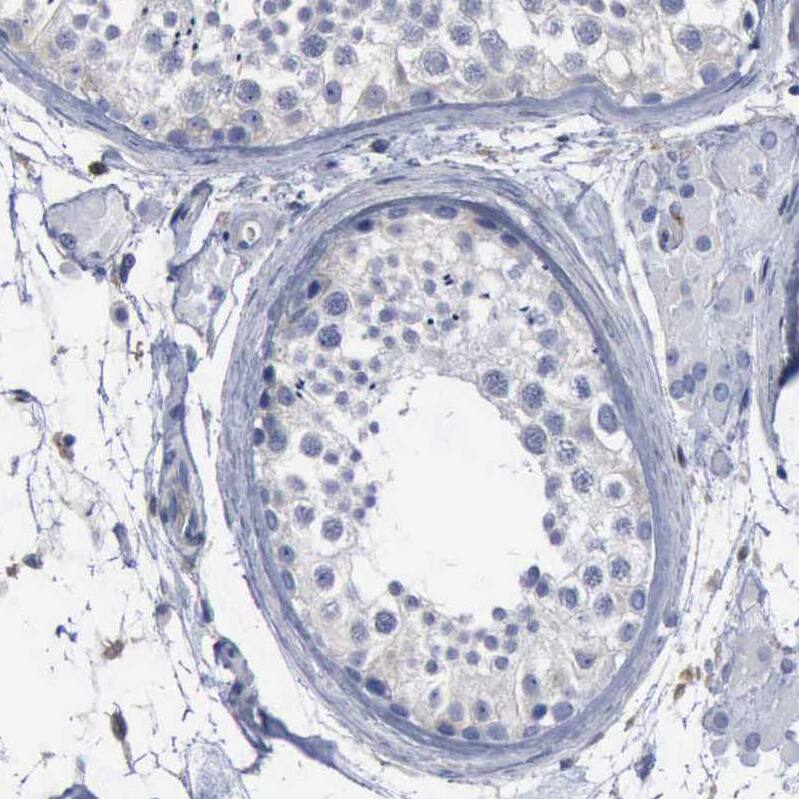 Staining of human testis shows no positivity in cells in seminiferous ducts.