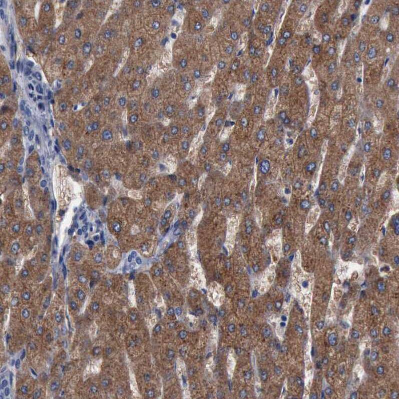 Staining of human liver shows strong cytoplasmic positivity in hepatocytes.