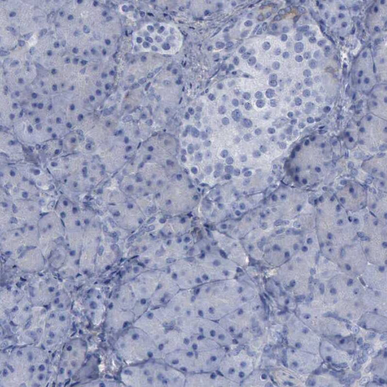 Staining of human pancreas shows no positivity in exocrine glandular cells.