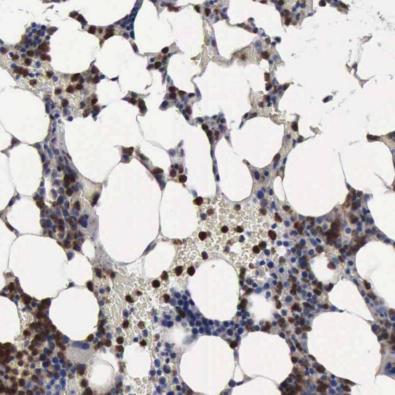Staining of human bone marrow shows strong cytoplasmic positivity in hematopoietic cells.