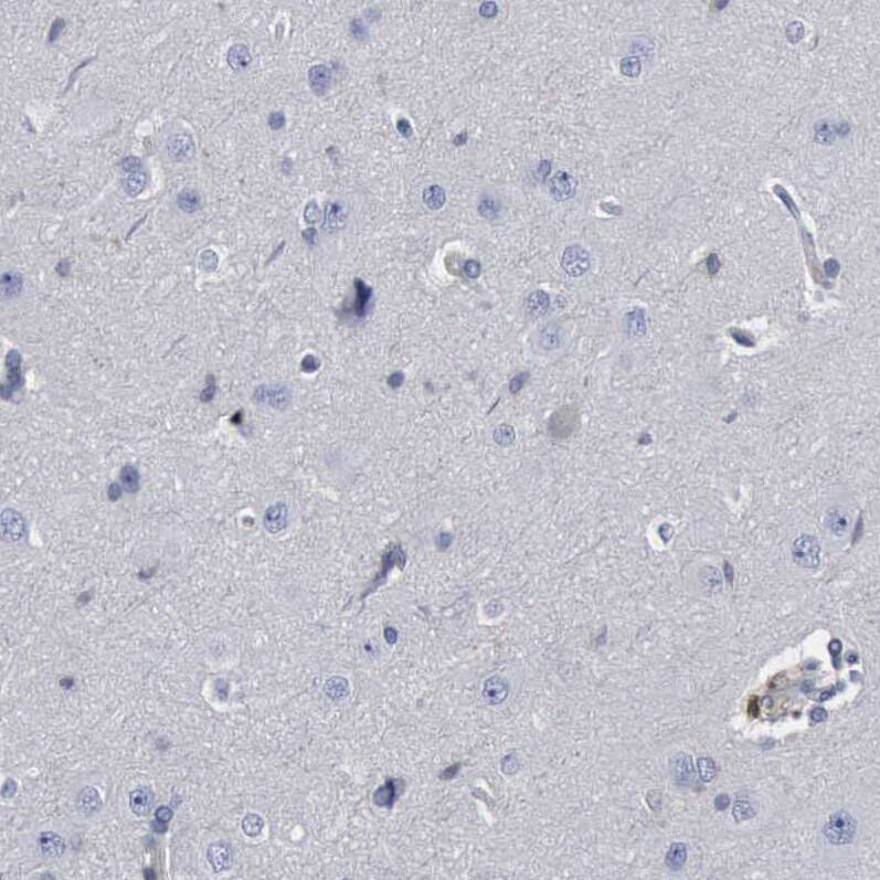 Staining of human cerebral cortex shows no positivity in neurons.