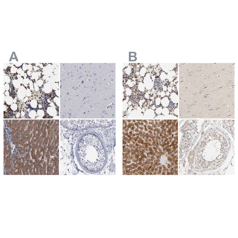 Staining of human bone marrow, cerebral cortex, liver and testis HPA000962 (A) shows similar protein distribution across tissues to independent antibody HPA004119 (B).