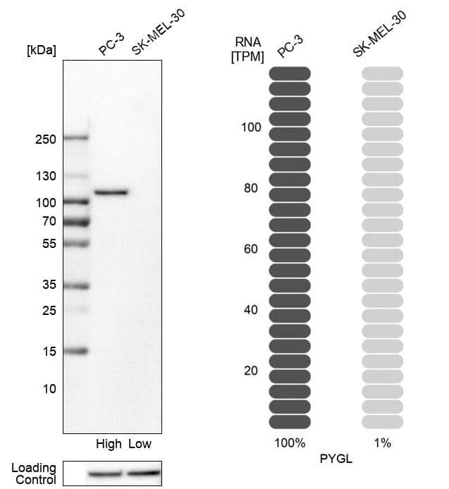 Analysis in human cell lines PC-3 and SK-MEL-30 using Anti-PYGL antibody. Corresponding PYGL RNA-seq data are presented for the same cell lines. Loading control: Anti-HSP90B1.