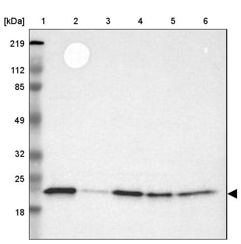 Lane 1: Marker [kDa] 219, 112, 85, 49, 32, 25, 18Lane 2: Human cell line RT-4Lane 3: Human cell line EFO-21Lane 4: Human cell line A-431Lane 5: Human liver tissueLane 6: Human tonsil tissue