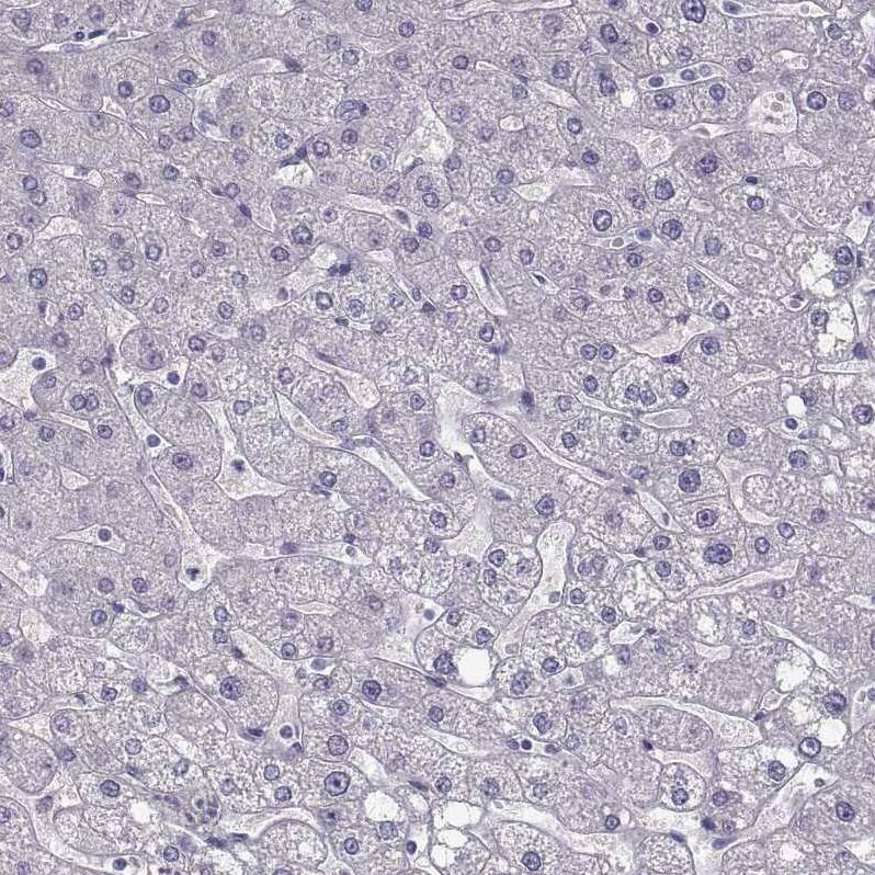 Staining of human liver shows no positivity in hepatocytes as expected.