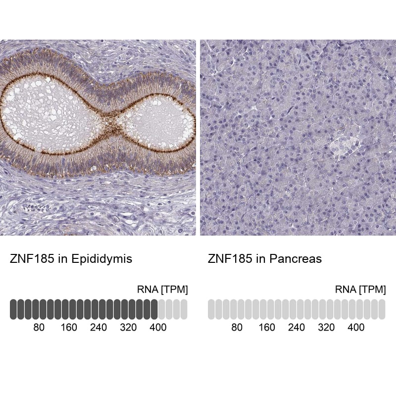 Immunohistochemistry analysis in human epididymis and pancreas tissues using HPA000400 antibody. Corresponding ZNF185 RNA-seq data are presented for the same tissues.