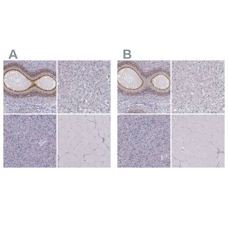 Staining of human epididymis, liver, pancreas and skeletal muscle using Anti-ZNF185 antibody NBP1-86192 (A) shows similar protein distribution across tissues to independent antibody NBP1-86452 (B).