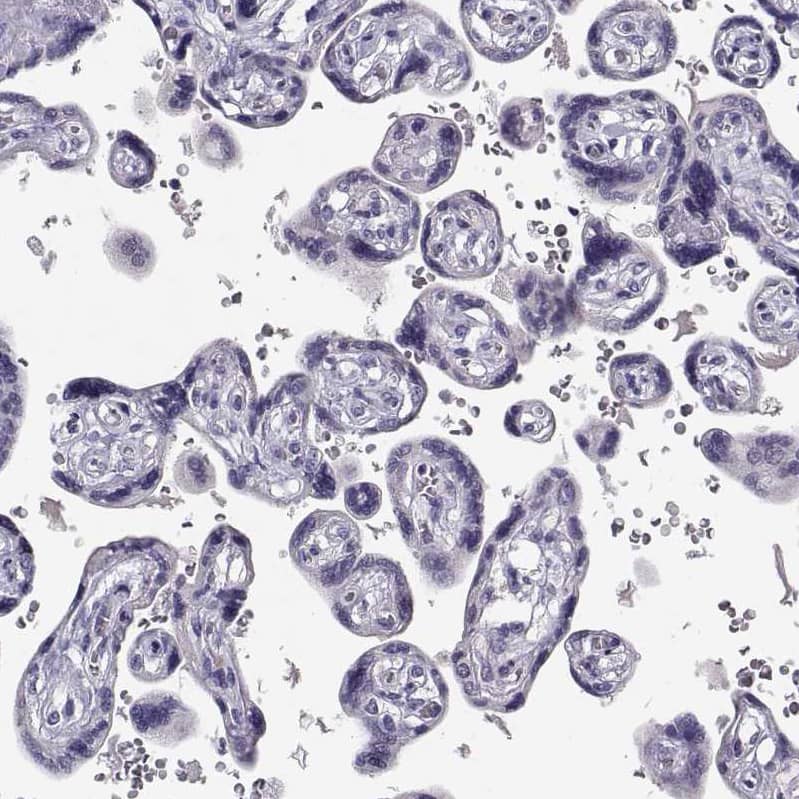Staining of human placenta shows no positivity in trophoblastic cells as expected.