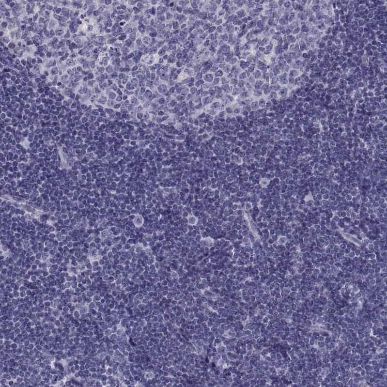 Staining of human tonsil shows no positivity in non-germinal center cells as expected.