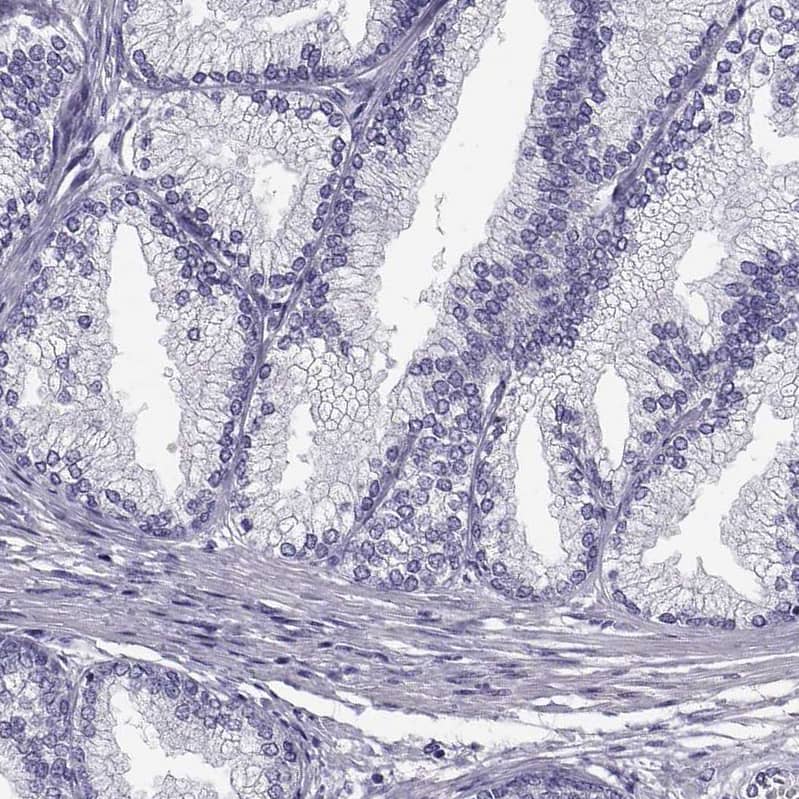Staining of human prostate shows no positivity in glandular cells as expected.