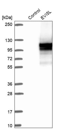 Analysis in control (vector only transfected HEK293T lysate) and EVI5L over-expression lysate (Co-expressed with a C-terminal myc-DDK tag (~3.1 kDa) in mammalian HEK293T cells).
