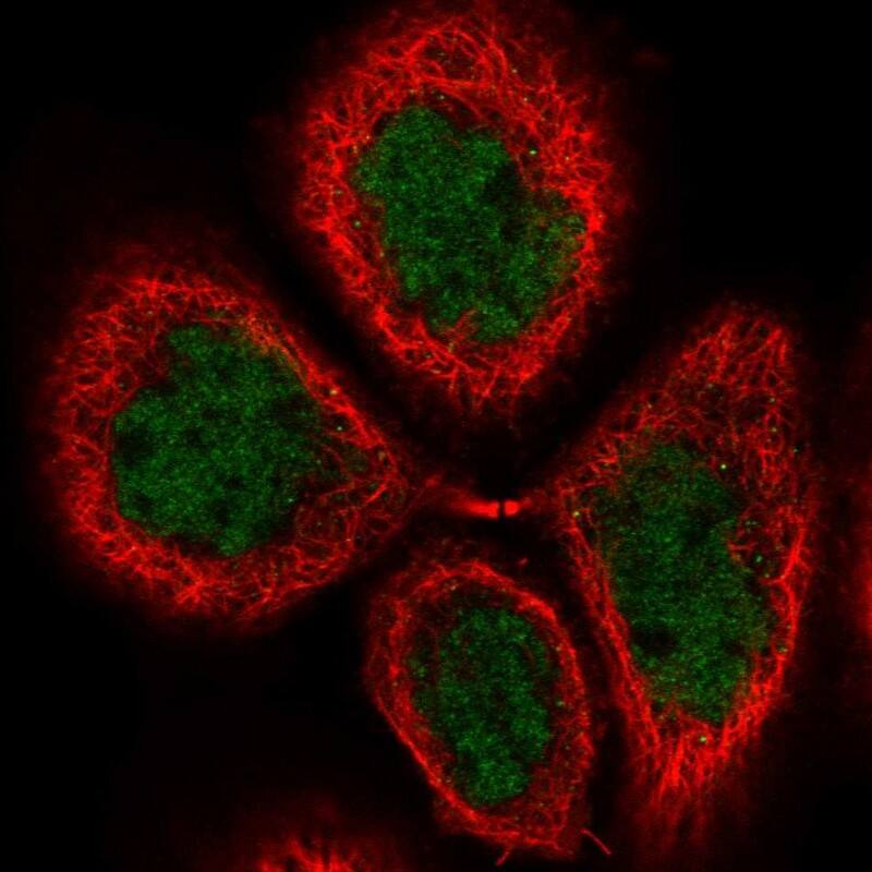 Staining of human cell line A-431 shows localization to nucleoplasm.